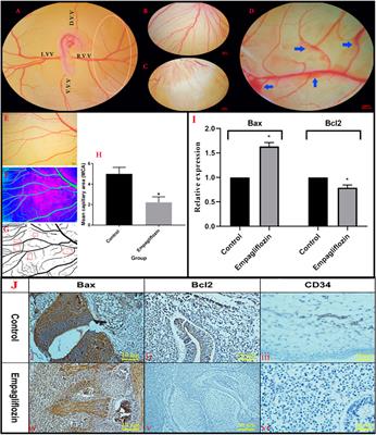 Empagliflozin induces apoptotic-signaling pathway in embryonic vasculature: In vivo and in silico approaches via chick’s yolk sac membrane model